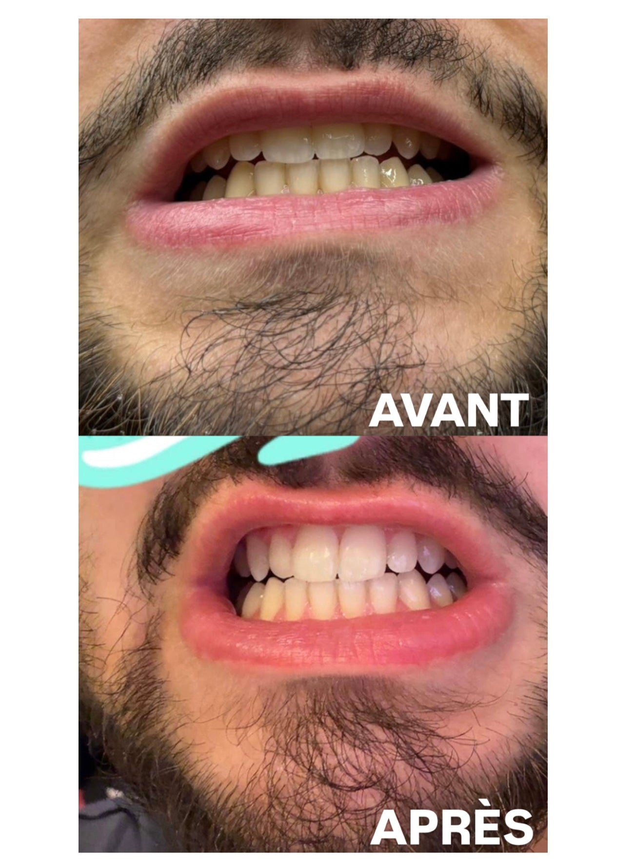 DENTIFRICE PALMCARE WHITENING+