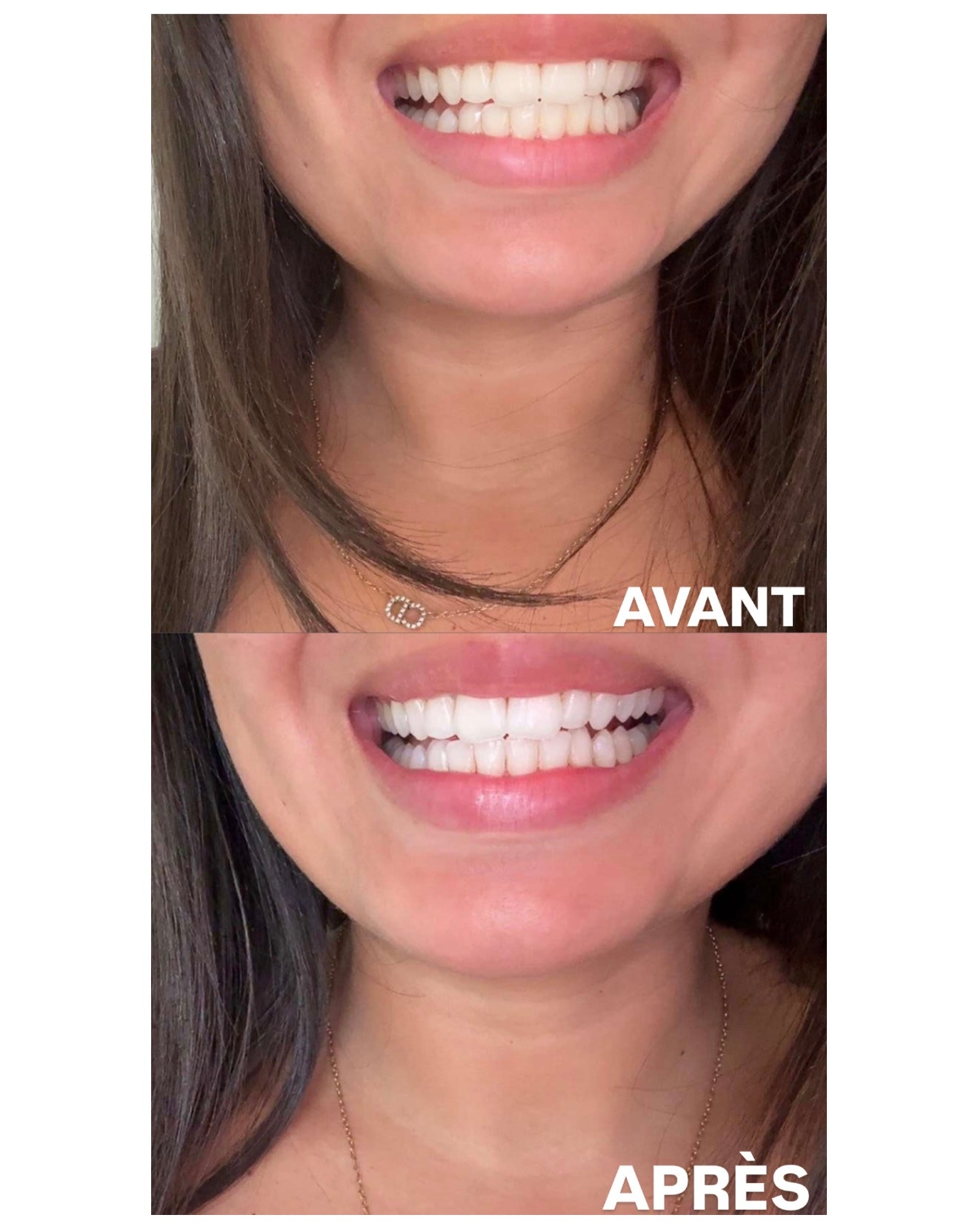 DENTIFRICE PALMCARE WHITENING+