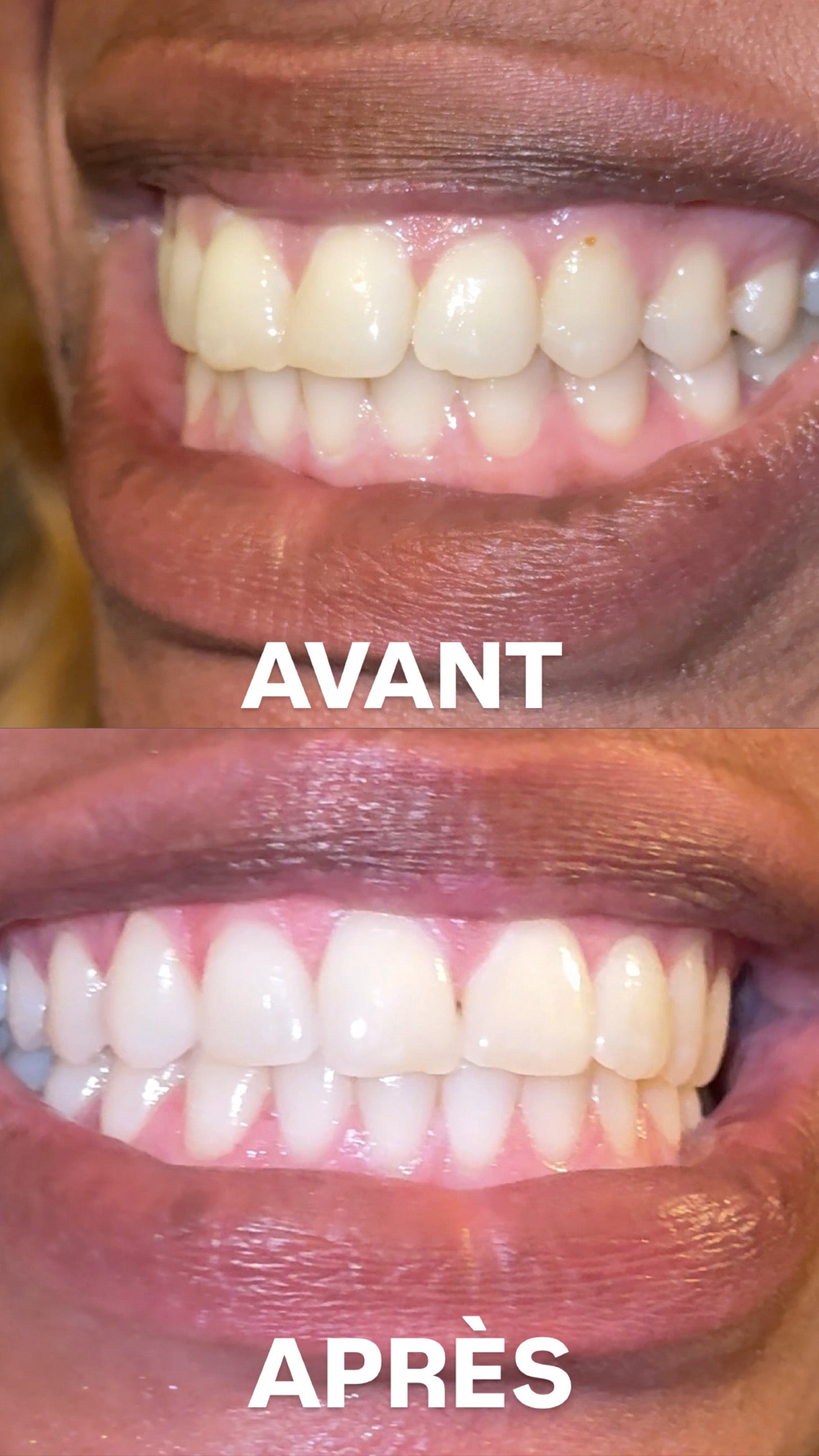 DENTIFRICE PALMCARE WHITENING+